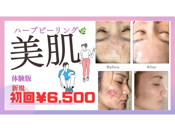 ワン(ONE)の写真/新規限定【皮むけあり】ハーブピーリングで肌を結に♪