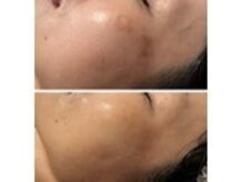 ベル(belle)の雰囲気（シミケア、エイジングケアも得意です◎）