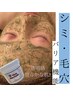 【シミ毛穴ケア】ハーブピーリング+ヘッドマッサージ付¥15,400→¥9,900