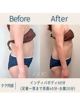スー(Sue)/ボディ60分before→after