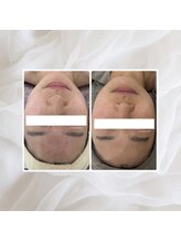 プリマプリート 名駅店/VOSサロンケア