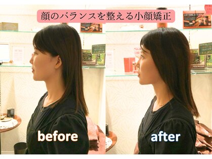 おかもと鍼灸整骨院の写真