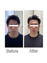 シンメトリー 千葉店/顔のこりもほぐれます！