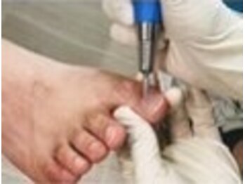 小田急相模原巻き爪矯正センター