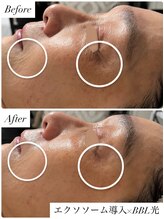 シェリ フルール(Cheri Fleur)/１回でも目に見える効果が嬉しい