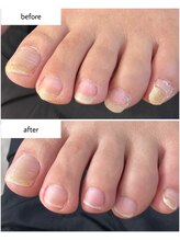 ケアプラス(care plus)/フットケア