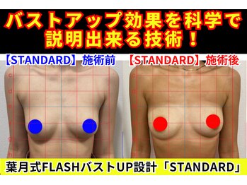 セブンシーズ 上野店(Seven Seas)/お胸の細胞を膨張させるエステ！