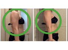 ヨサパーク ペチュニア 世田谷店(YOSA PARK Petunia)/二の腕スッキリ