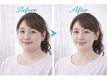 アプロ(Aphro)/フェイスラン変化