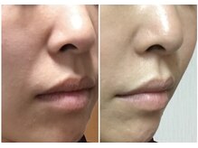 ココ(coco)/エイジングケアはお早めに♪