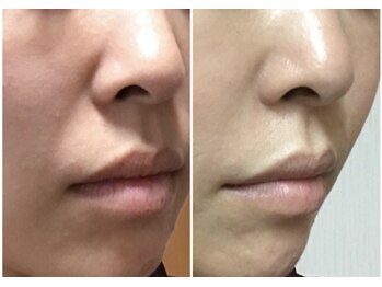 ココ(coco)/エイジングケアはお早めに♪