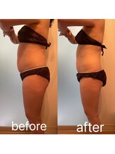 リンパケアサロン ジュビル(Jubil)/ダイエット成功者続出！！