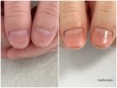 深爪矯正　デザインネイル