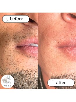 ドゥ(doux)/メンズフェイスワックス