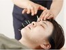 【初回特価/小顔矯正】プロの美容鍼 ¥5,500→¥3850