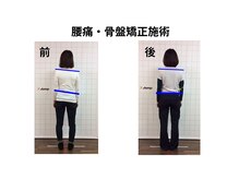 ジャンプ(Jump)/腰痛・骨盤矯正・トレーニング