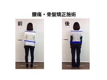 ジャンプ(Jump)/腰痛・骨盤矯正・トレーニング
