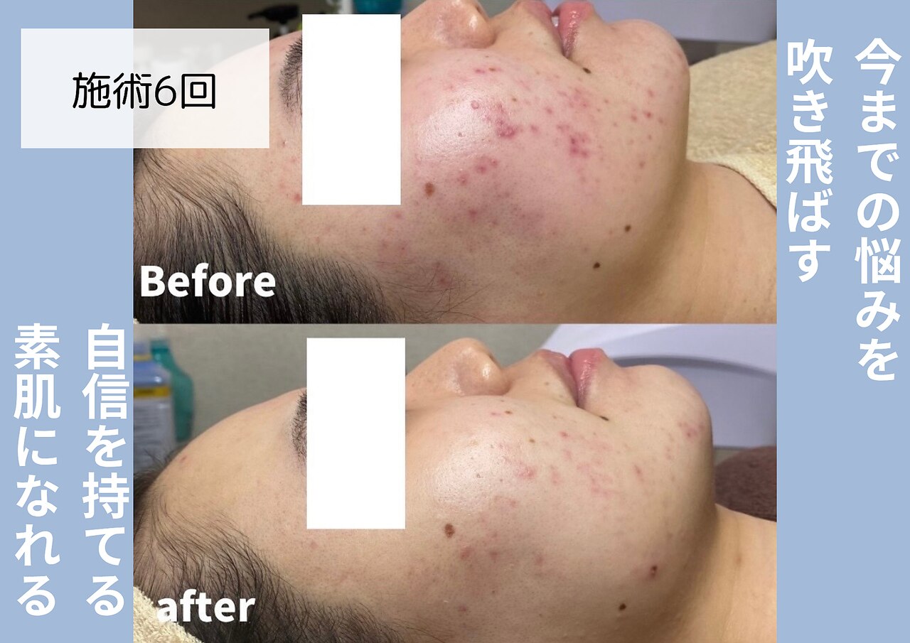 ビオルブ(VIOLVE)｜ホットペッパービューティー