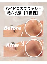 ビレボ マエバシ(BEREVO maebashi)/Before After