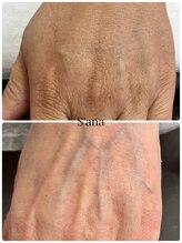 サナ 久が原 千鳥町(S’ana)/ルビッシュ照射