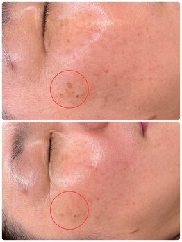 杉田鍼灸整骨院/４０代女性