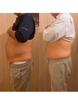 フローズン アロヒ(Frozen ALOHI)の写真/男性特有のぽっこりお腹に♪理想の自分へ！効率よくアプローチ！自信を育むエステ