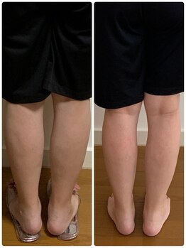 ヨサ パーク コアハート(YOSA PARK CORE HEART)/水素足湯