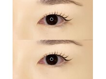 アーラ(ala)/flat×2（50）