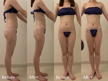 ラヴィエ ベル(La vie est belle)/セルライトゼロ2 全身