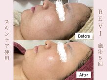 ルア(LuA.)/くすみ改善◎