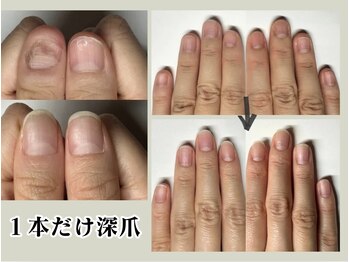 クウ(KUU)/1本でも10本施術