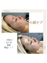 ファロンビューティー(fallon beauty)/小顔フェイシャルケア
