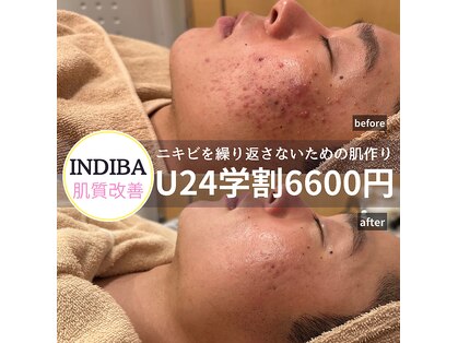 ジュノ メディカルエステティックサロン 栄店の写真