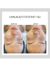 ポムハヌル 大阪梅田中崎町(pom.haneul)/韓国肌管理室