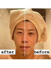 ポーラ 大阪十三店(POLA)/メンズエステも対応しております