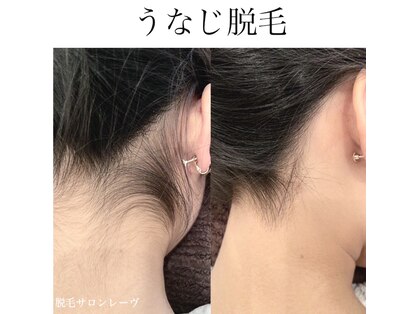 レーヴの写真