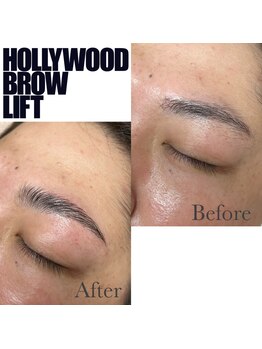 マテオ(Matteo)/ハリウッドブロウリフト/HBL