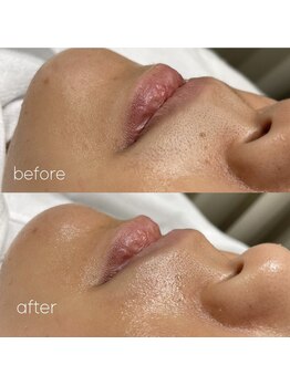 リルドアイラッシュ(Lilld eyelash)/