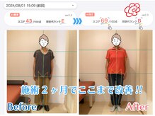 新所沢美原町整体院/10代から80代の姿勢改善実績◎