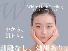 ラトナ(RATNA)/人気の剥離なし