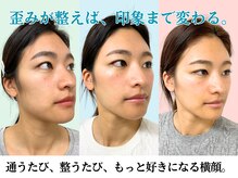ナチュラルビューティーフェイス 横浜(NBF)