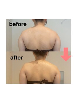 シャイン(shine)/デトックスリンパ90分 1回