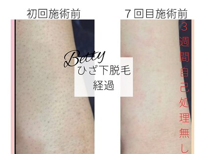 ベティ(Betty)の写真