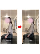 ナオル整体 十条院(NAORU整体)/before/after　【十条/猫背】