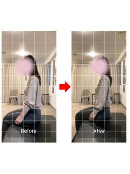 ナオル整体 十条院(NAORU整体)/before/after 【十条/猫背】