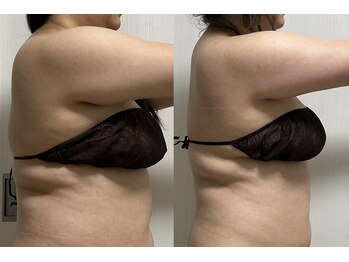 ピクシー(pixie)の写真/一人ひとりの体悩みに合わせたオーダーメイドケアで、自分史上最高のシルエットへ！あなたの理想を叶える◎