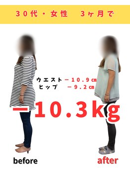 佐々木整骨院/ダイエット終了【30代女性】