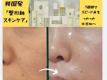 マールム(MALUM)/インセルダム