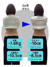 Noa接骨院 はりきゅう院/去年買ったスーツを着たい！