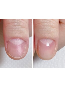 爪の悩みを解消できる（ケア含む）